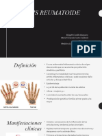 Artritis Reumatoide