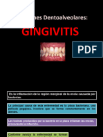 GINGIVITIS