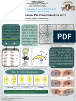 L'effet Prismatique Par Decentrement Du Verre