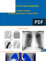 Sesion 5 - Patron Alveolar y Atelectasia