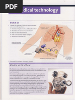 Switch On: Artificial Heart Mechanism