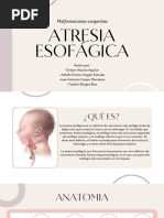 Atresia Esofagica