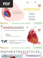 Arritmias Ventriculares