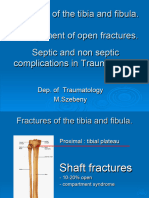 Management of Open Fractures Prof A Sárváry Septic and Non Septic Complications in Traumatology Fractures of The Tibia and Fibula