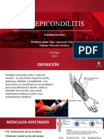 Epicondilitis