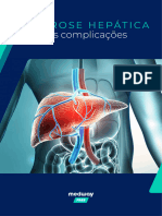 Ebook Cirrose Hepatica e Suas Complicacoes