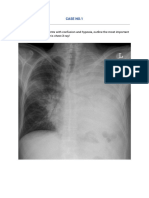 150+ Cases in Chest Xray