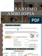 Estrabismo y Ambliopia