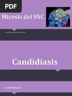 Micosis Del SNC