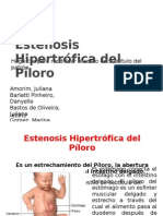 Estenosis Hipertrófica Del Píloro