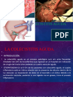 Colecistitis Aguda