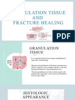 Granulation Tissue and Fracture Healing. (Final)