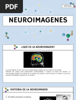 Neuroimagenes