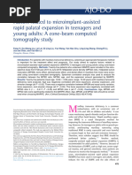 Factors Related To Microimplant Assisted Rapid Pal