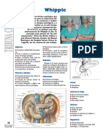 Pdf-Whipple Compress