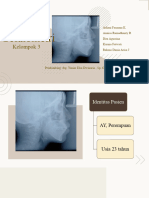 Analisis Sefalometri Kelompok 4