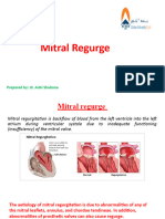 3 Three - Mitral Regurge