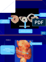 Patología Corazón y Tiroides