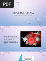 Trombocitopenia