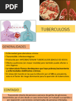 2 Tuberculosis