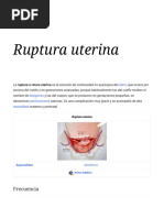 Ruptura Uterina - Wikipedia, La Enciclopedia Libre