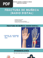 Fractura de Muñeca