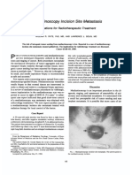 Cancer - 1 January 1989 - Rate - Mediastinoscopy Incision Site Metastasis Implications For Radiotherapeutic Treatment