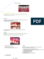 Retalhos em Periodontia - Resumo