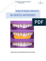 Restauraciones Resina Compuesta Anteriores 2023