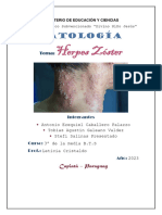 PATOLOGÍA. Herpes Zóster