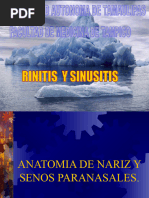 Rinitis y Sinusitis