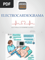 1 Ekg