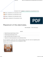 Placement of The Electrodes. - How To - I-Tech Medical Division