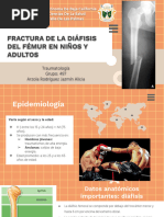 Fractura de La Diáfisis Femoral