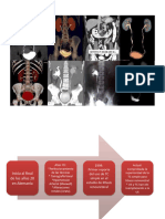 Patologías en Urograma Excretor