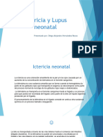 Ictericia y Lupus Neonatal