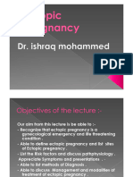 Ectopic Pregnancy