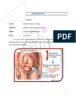 PNC Case Study On Gestational DM