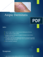 Atopic Dermitatis