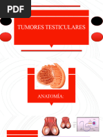 Tumor Testicular