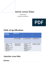 Anterior Cross Bite