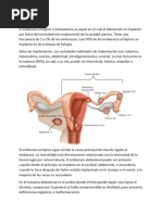 Embarazo Ectopico