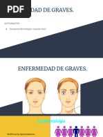 Enfermedad de Graves