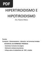 Hipertiroidismo