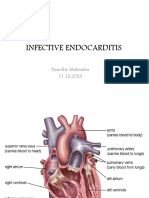 Infective Endocarditis.... Mshemba