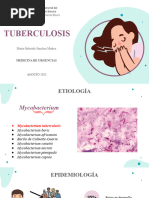 Tuberculosis