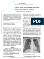 Congenital Descending Aorta To Pulmonary Vein.11