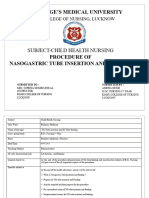 NG Tube Feeding (Procedure Lesson Plan)