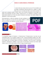 4 - Leiomiomas e Sarcomas Uterinos