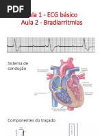 ECG e Bradicardia